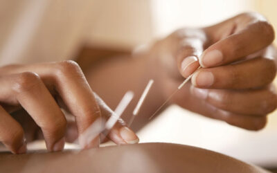 Acupuncture for IVF – what’s the research?