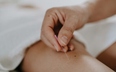 Acupuncture: The Basics
