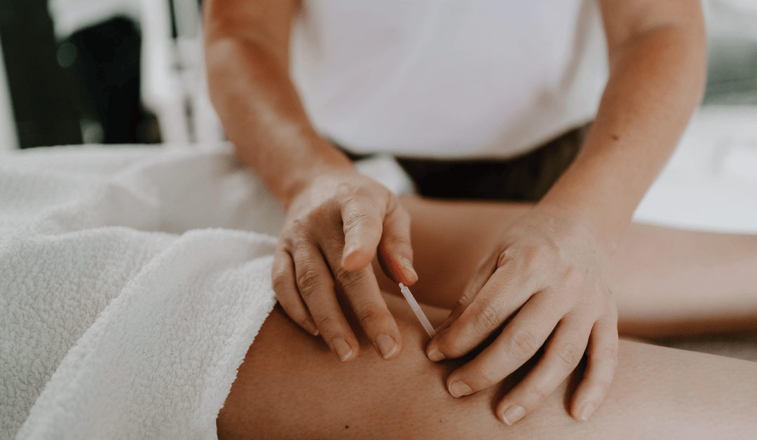 woman performing acupuncture for PMOS on a woman in Brisbane